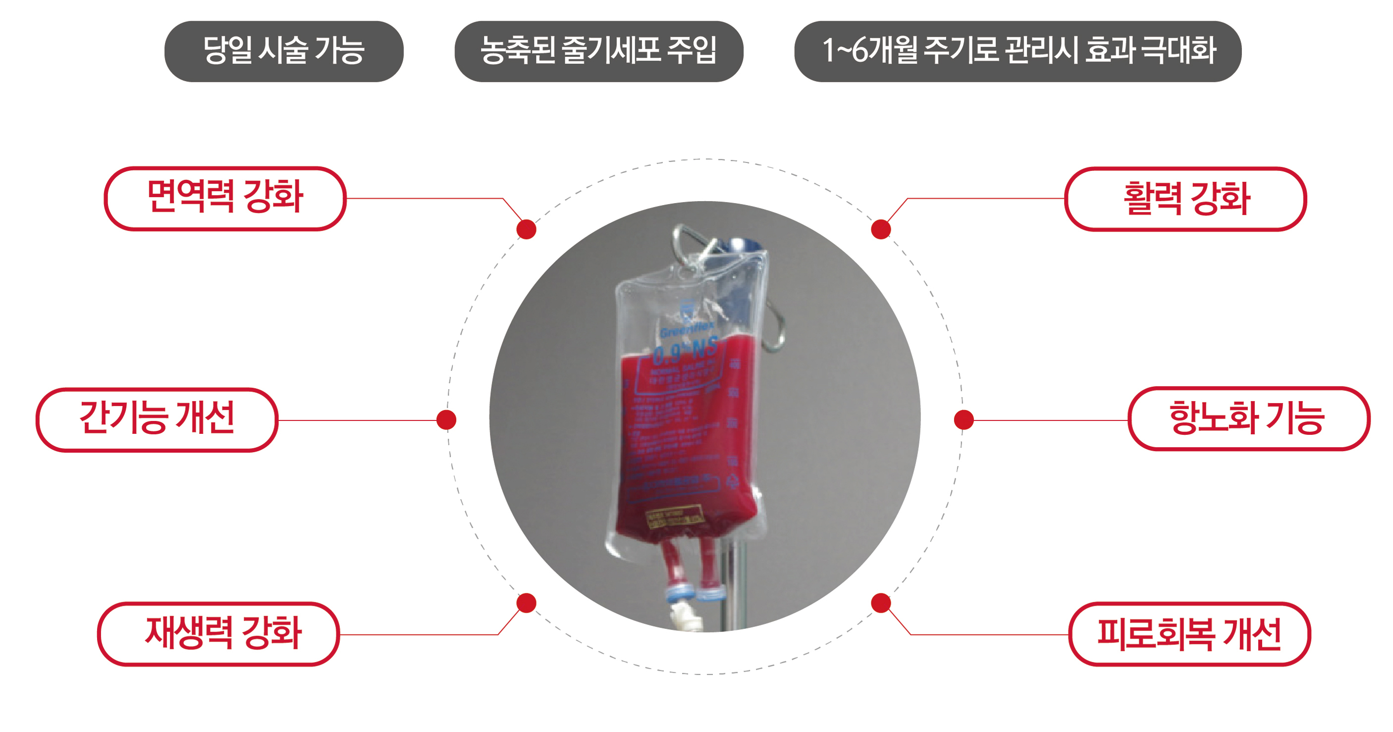 줄기세포 주입 이미지